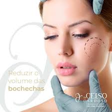 Dr. Celso Cardoso (@dr.celsocardoso) · Instagram 照片和视频