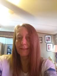 Hello well I'm not doing so well I have kidney failure and I lost oneof my  kidneys and the other is bearly hanging