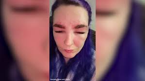 Stretford Mum Suffers Shock Reaction To Eyebrow Dye In Salon