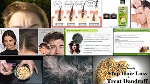 13 january 2021 / in baldness, hair loss blog / by admin. Does Coconut Oil Help Regrow My Hair Or Increase My Forehead Wrinkles Quora