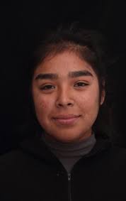 Orthodontic approach to gemination: a clinical case report