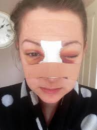 Stunning brunette battered so badly by ex-boyfriend she needed a new nose —  but now she's a beauty queen