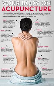 10 Pretty Fantastic Reasons To Try Acupuncture Acupuncture Benefits Acupuncture Massage Therapy