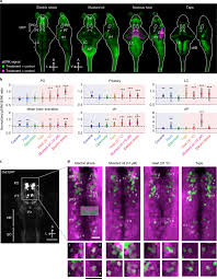Electrical shock, the perceptible and physical effect of an. Zebrafish Oxytocin Neurons Drive Nocifensive Behavior Via Brainstem Premotor Targets Nature Neuroscience