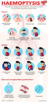 Yang menjadi masalah bukan batuknya, tapi sumber/penyebab terjadinya batuk tersebut. Bernama On Twitter Infografik Haemoptysis Batuk Berdarah