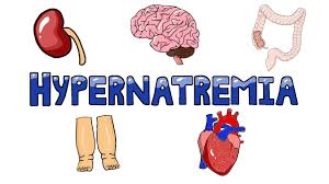 Image result for Hypernatremia