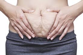 We did not find results for: Diastasis Recti Symptoms Stomach Back Pain Pelvic Floor Issues Ryc
