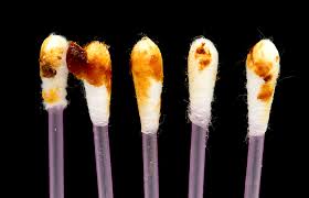 35 Prototypic Black Ear Wax