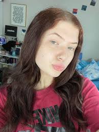 how Numinous Skin Co. has my skin looking 😍😍 clearing my acne and making  my skin so soft,glowy, and hydrated with the all natural, antibacterial and  anti fungal properties ! i've been