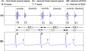 How to calculate heart rate from ecg. Heart Sound Signals Can Be Used For Emotion Recognition Scientific Reports