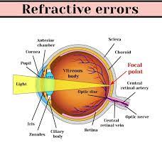 A Guide to Common Eye Disorders