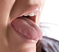 A chronically swollen tongue over a long period of time can be due to acromegaly, sarcoma, oral cancer, or down syndrome. What Are The Common Causes Of Tongue Swelling With Pictures