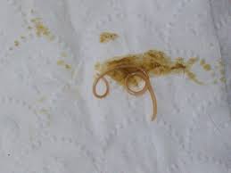 I quickly grabbed the stain remover and added a dash of disinfectant, and in under 3 minutes the stain was 99% gone. Dog Vomiting Yellow Bile Yellow Foam With Diarrhea And Blood In The Morning After Drinking Water What To Give