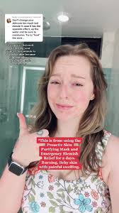 Replying to @ymahopkins catch me looking extra rough in my vacay photos.  #skincare101 #skincare #fail #allergicreaction