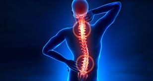 Resultado de imagen para imagenes de hernia de discos