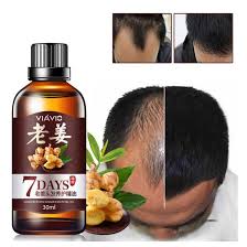 We just saw the many hair benefits of ginger. Ginger Juice Hair Growth Serum Hair Loss Regrowth Treatments For Men Women Suitable For All Types Of Hair Shopee Malaysia