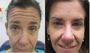 Ben Behnam, MD, Dermatologic Surgeon, Board Certified in Dermatology