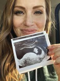Sep 16, 2020 · hgtv star mina starsiak and husband welcome 2nd child — a baby girl! Lesen Sie Hgtv S Mina Starsiak My Miracle Pregnancy Online