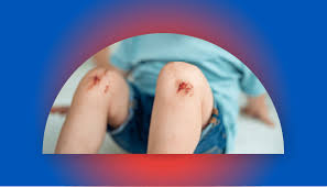 Image result for Wound