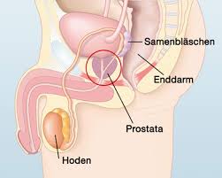 Prostatakrebs Symptome Diagnose Therapie Apotheken Umschau