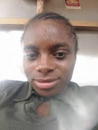 Help my sister!!! What can she use for those stubborn pimples?