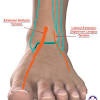 The extrinsic muscles of the foot originate from the anterior, posterior and lateral compartments of the leg. 1