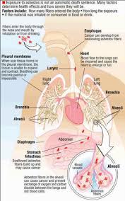 What causes mesothelioma, and how is it different from lung cancer? Mesothelioma Lung Cancer Asbestos Victims Advocate 800 714 0303