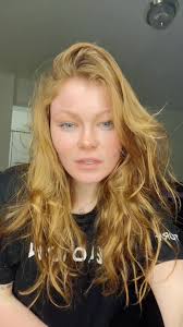 Literally ignore my chapped lips from accutane