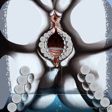 Rule Against Glass Anus Ass Ass On Glass Butt Shot Clitoris 13098 | Hot Sex  Picture