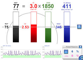 Chart Bars Screen Lidco Hemodynamic Monitoring For The