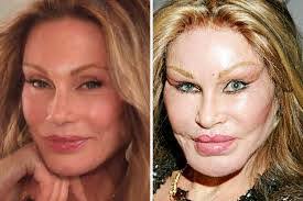 Here's what i've learned since my first cosmetic procedure 25 years ago. Celebrity Plastic Surgeries Home Facebook