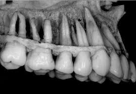 Pin On Dental