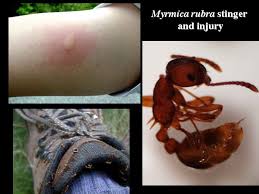 Image result for Fire Ant Sting