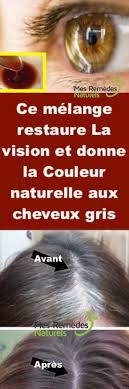 Ce Melange Restaure La Vision Et Donne La Couleur Naturelle Aux Cheveux Gris Health And Beauty Health Health Tips