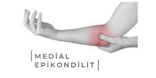 medial epikondilit golfcu dirsegi nedir belirtileri ve tedavisi ki ri s golf kol kaslari