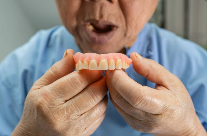 Overdentures product image