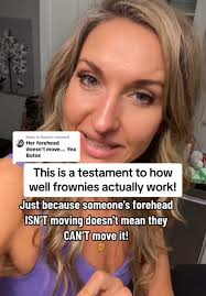 How to Apply Frownies Around Mouth: Smile Line Prevention Tutorial