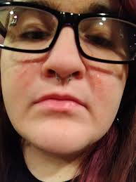 I don't think this is psoriasis but does anyone recognize what it might be? 