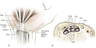 It acts best when the wrist broaden. Wrist And Hand Clinical Gate