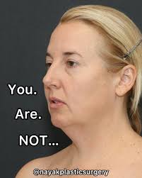 Nayak Plastic Surgery