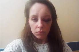 NYPD Officer Accused Of Arresting Woman, Dating Her, Leaving Her Passed Out  With A Black Eye