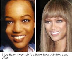 Find useful and attractive results. Nose Job Without Surgery For Wide Nose Guide At Job Share Real Com