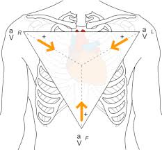 Unipolar Leads Ecg Lead Placement Normal Function Of The Heart Cardiology Teaching Package Practice Learning Division Of Nursing The University Of Nottingham
