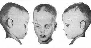 Boy in the box (also known as america's unknown child and the fox chase boy ) is the nickname given to a boy found murdered in the fox chase area of philadelphia, pennsylvania in 1957. Who Was The Boy In The Box And How Did He Die