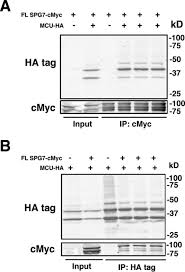 Check spelling or type a new query. Spg7 Targets The M Aaa Protease Complex To Process Mcu For Uniporter Assembly Ca2 Influx And Regulation Of Mitochondrial Permeability Transition Pore Opening Journal Of Biological Chemistry