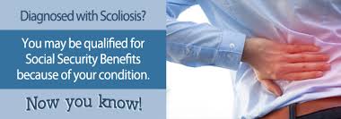 Why Was My Scoliosis Claim Denied Disability Benefits Center