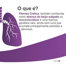 Apesar de ser rara, é a doença genética mais frequente entre caucasianos e afeta 1 em cada 7000 pessoas em portugal. Apae De Vitoria Voce Ja Ouviu Falar Da Fibrose Facebook