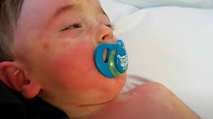 An individual aged <21 years presenting with fever*, laboratory evidence of inflammation**, and evidence of clinically severe illness requiring hospitalization, with multisystem (>2) organ involvement. Dhec Confirms First Cases Of Mis C Associated With Covid 19 In South Carolina Children Wsav Tv