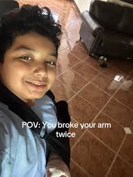 Double Broken Arms