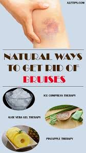 Natural Ways To Get Rid Of Bruises Fast Heal Bruises Faster Heal Bruises Bruises Remedy